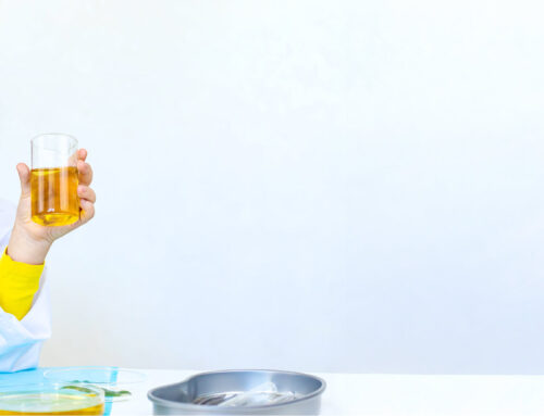 Dynamic Image Analysis (DIA) Compared to Micro-Flow Imaging?