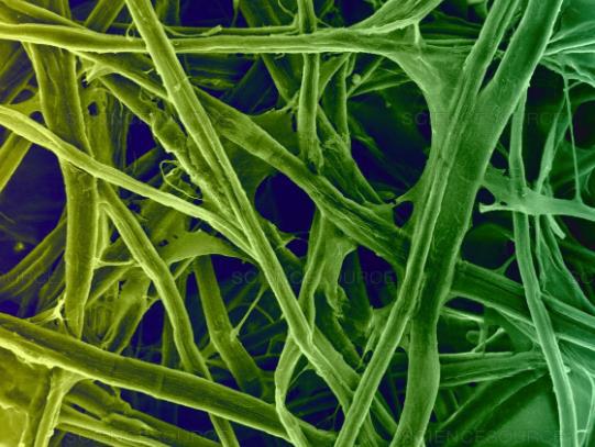 Cellulose Fibers dynamic imaging