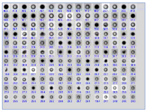 Thumbnail images of oil droplets and air bubbles using dynamic image analysis